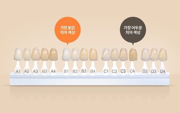 치아 밝기를 16단계로 비교하는 색상 가이드